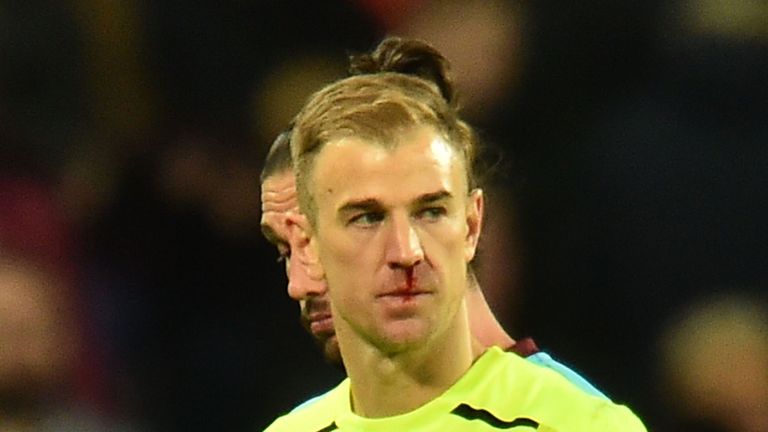 Joe Hart reflects on his error after Stoke take the lead at London Stadium
