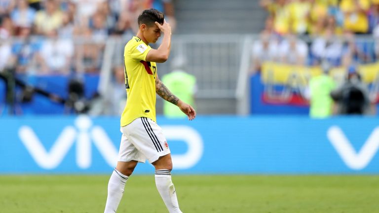 James Rodriguez hobbled off with 31 minutes gone of Colombia's win over Senegal
