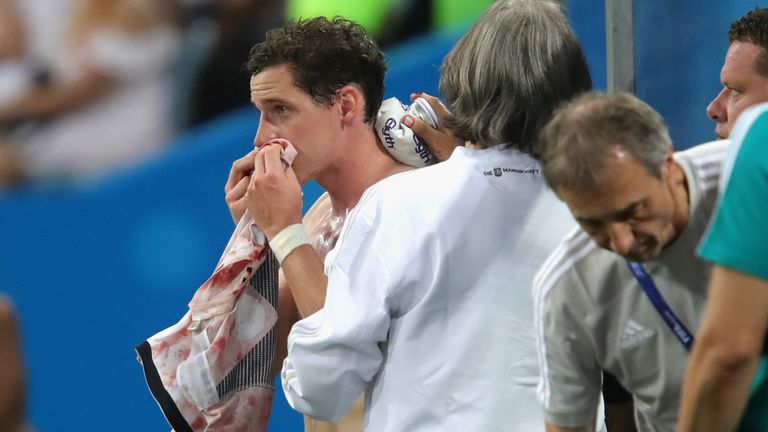 Sebastian Rudy receives treatment after picking up an injury against Sweden