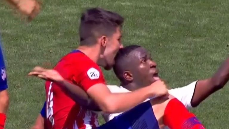 Vinicius Junior was bitten by Atletico Madrid B&#39;s captain while playing for Real Madrid Castilla on Sunday as the game ended 2-2.