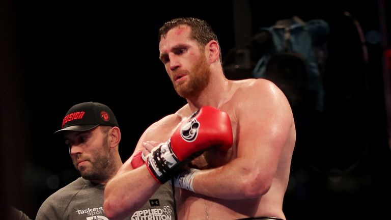 David Price holds his right arm after the fight