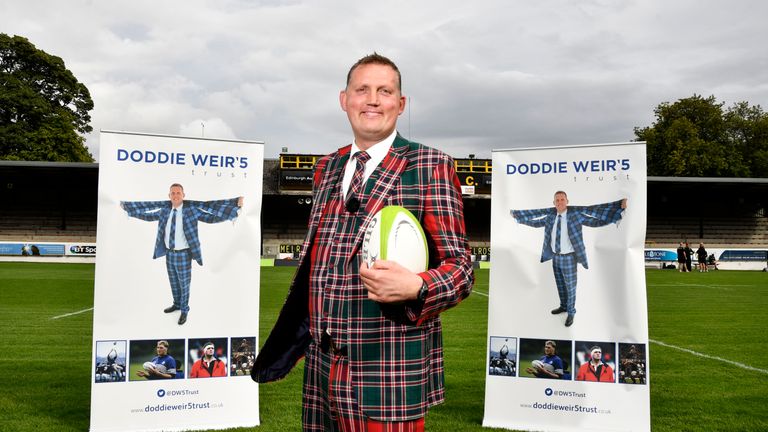 25/08/17.THE GREENYARDS - MELROSE.Former Scotland international Doddie Weir is pictured as he launches The Doddie Weir'5 Discretionary Trust and Foundation.