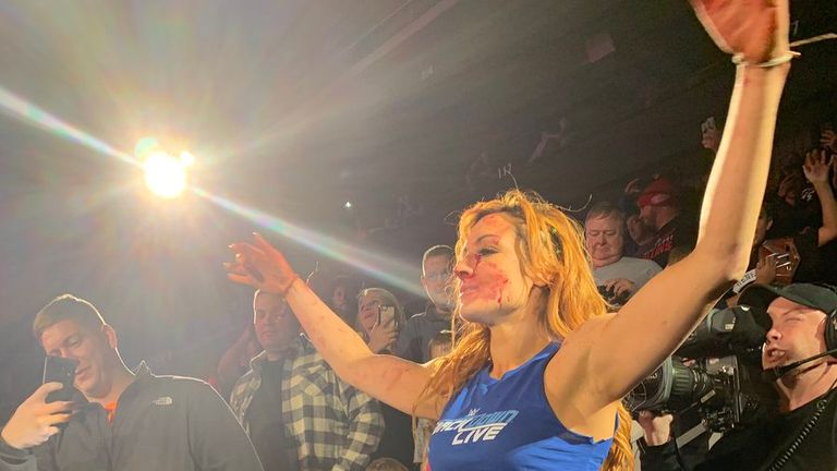 Becky Lynch was left bloodied after a brawl between the women of SmackDown and Raw

(picture: @BeckyLynchWWE)