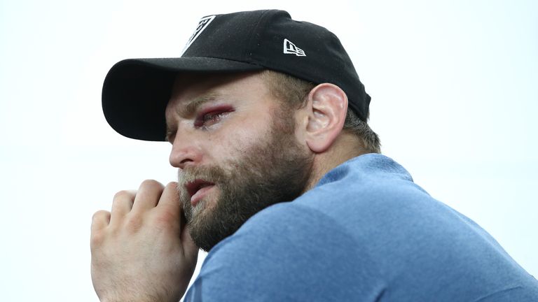 The gruesome injury rules Joe Moody out of New Zealand's remaining Tests in Europe