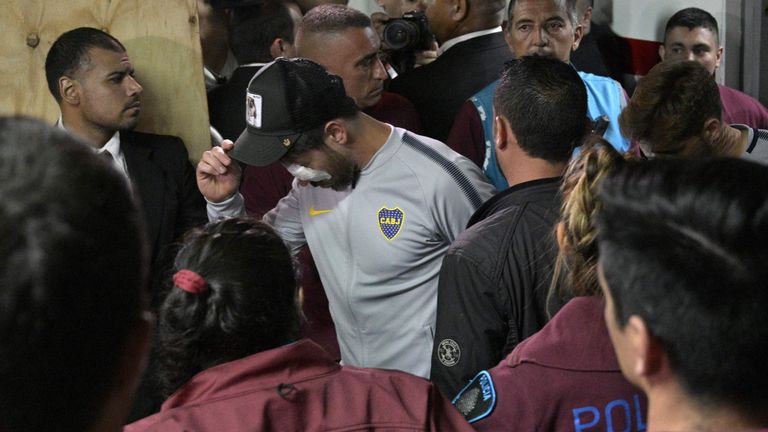 Boca Juniors&#39; Pablo Perez and others were treated for injuries after the bus attack