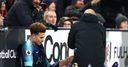 Alli injured in Fulham game