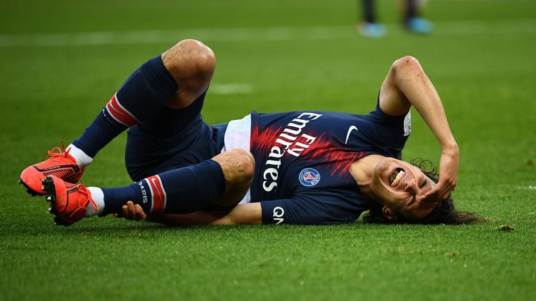 Edinson Cavani limped off for PSG ahead of Tuesday's Champions League match against Manchester United