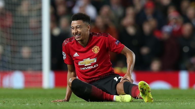 Jesse Lingard suffered an injury against PSG