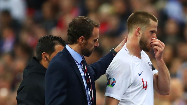 Eric Dier limps off for England against Czech Republic