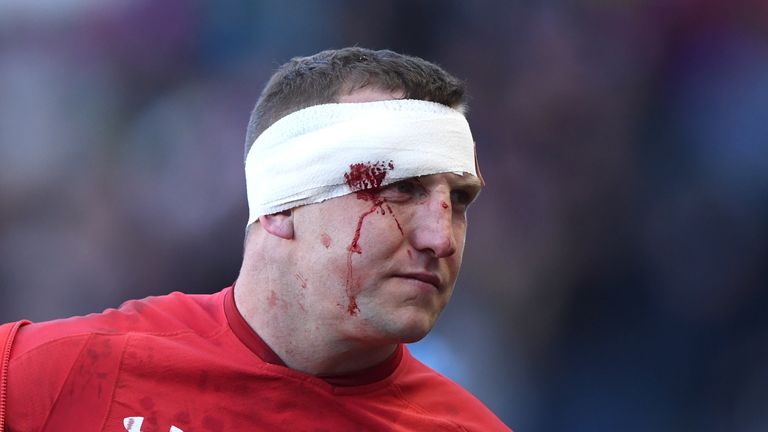 Hadleigh Parkes