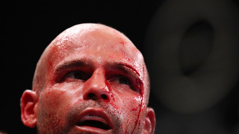 Kiko Martinez is stopped in the fifth round on cuts