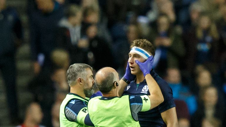 Jamie Ritchie is attended to by Scotland's medical staff
