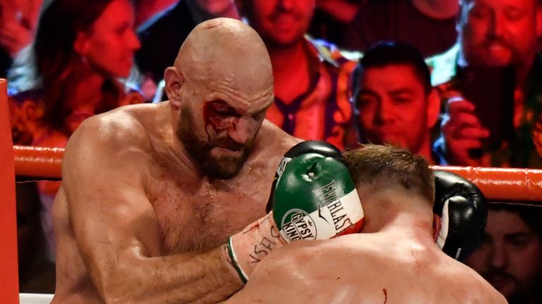 Tyson Fury