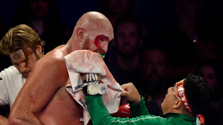 LAS VEGAS, NEVADA - Sept 14. .Suffering a cut above his right eye in the earl stages of the fight Tyson Fury(L) was able to finish 12 rounds with Otto Wallen Saturday at MGM Grand Garden Arena on Sept 14, 2019, Las Vegas, Nevada. Tyson Fury won the fight by  unanimous decision for the Linael Heavy Weight Championship title at T-Mobile Arena. (Photo by Gene Blevins/Getty Images)........