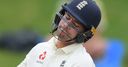 Burns a doubt after football injury
