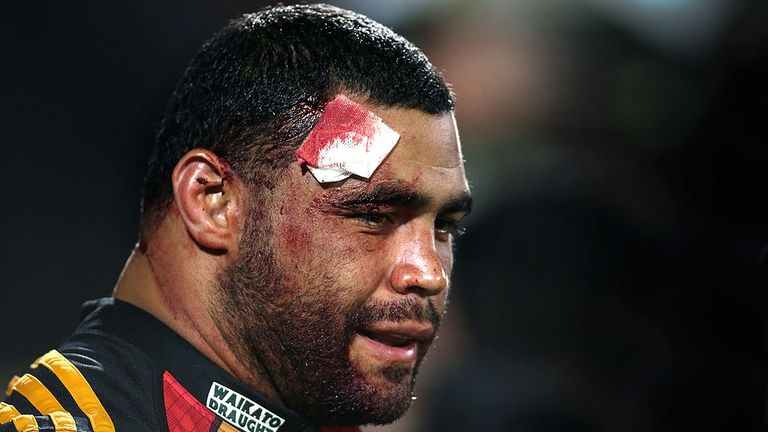 Ben Afeaki has promised to donate his brain for research 