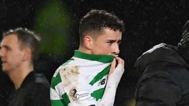 Image of Mikey Johnston limped off shortly before the end of Celtic's 3-0 win over St Johnstone
