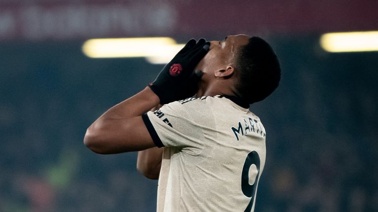 Manchester United&#39;s Anthony Martial holds his head in his hands after missing a chance against Liverpool.