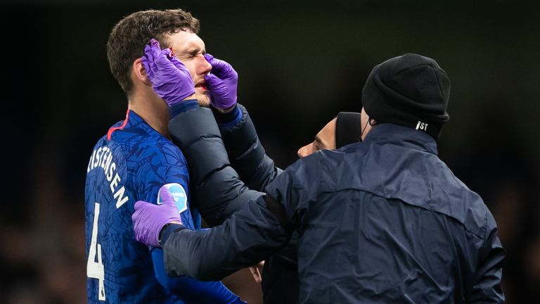 Andreas Christensen will be available for selection despite sustaining a broken nose against Manchester United
