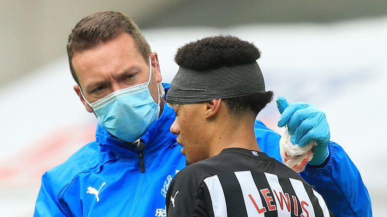Newcastle defender Jamal Lewis was treated for a head injury against Brighton last month  