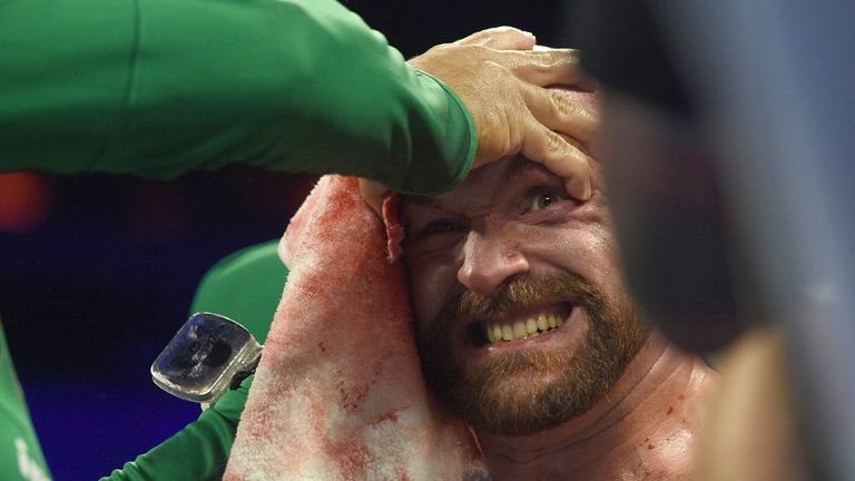 Fury overcame a huge obstacle against Wallin