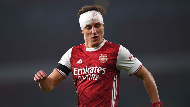 David Luiz sported a bloodied head bandage during the game against Wolves