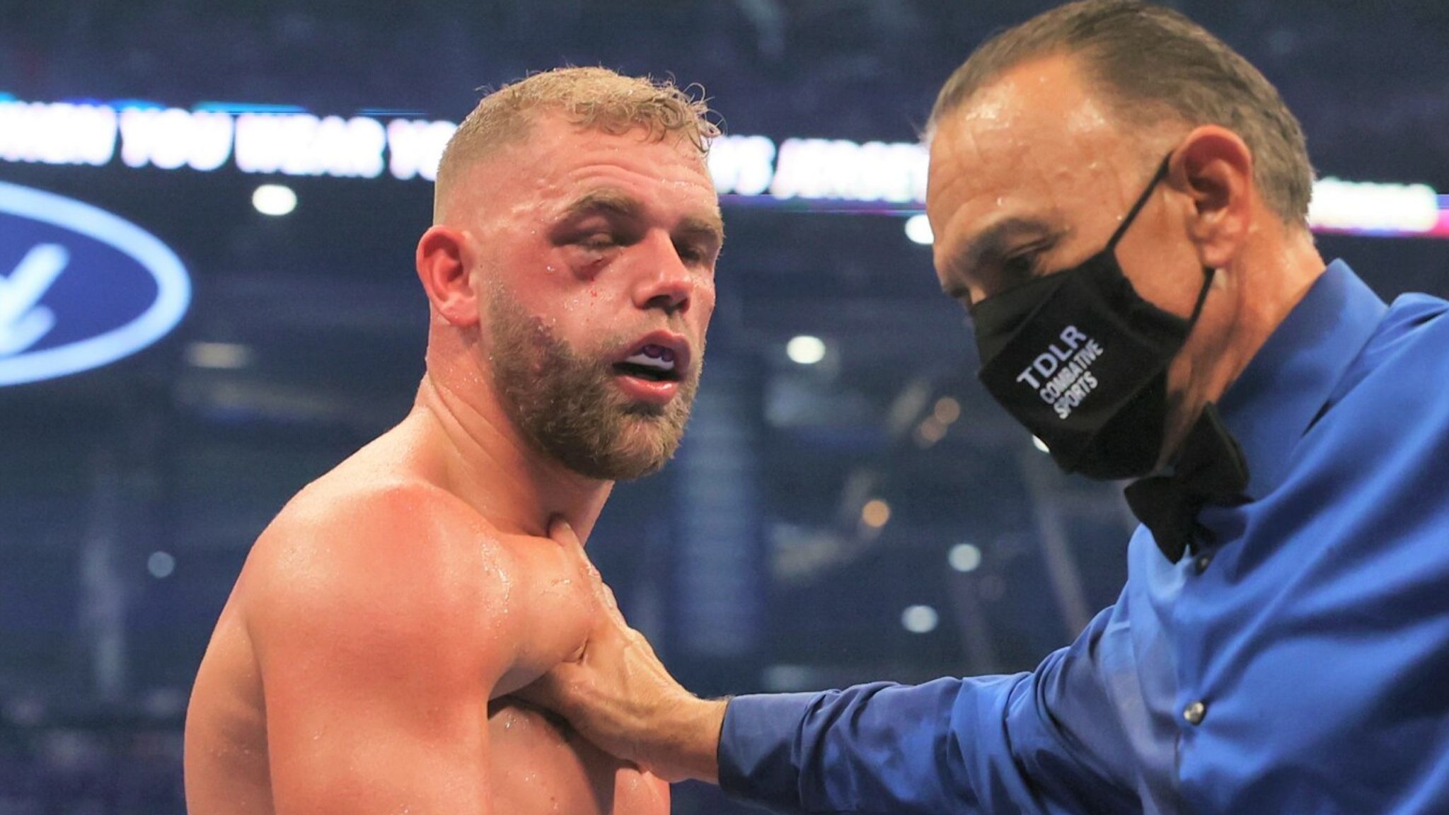 Billy Joe Saunders suffered broken eye socket during world ...