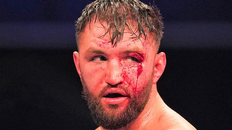 Hughie Fury 