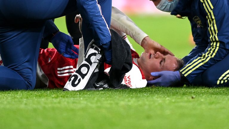 Arsenal's Rob Holding receives treatment before being concussion substituted during the Premier League match at the Emirates Stadium, London. Picture date: Sunday February 21, 2021.