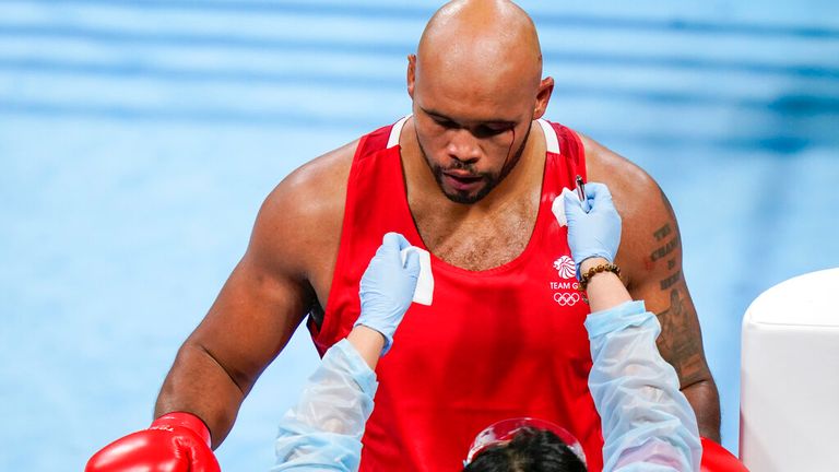 A medical professional checks a cut on Britain's Frazer Clarke during a men...s super heavyweight over 91-kg boxing match against Eliad Mourad, of France, at the 2020 Summer Olympics, Sunday, Aug. 1, 2021, in Tokyo, Japan. (AP Photo/Frank Franklin II)