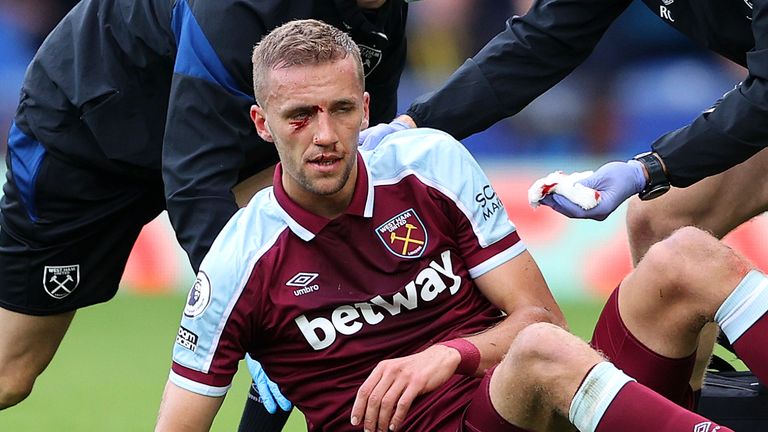 West Ham midfielder Tomas Soucek suffered a facial injury during Sunday&#39;s win at Everton (Getty)