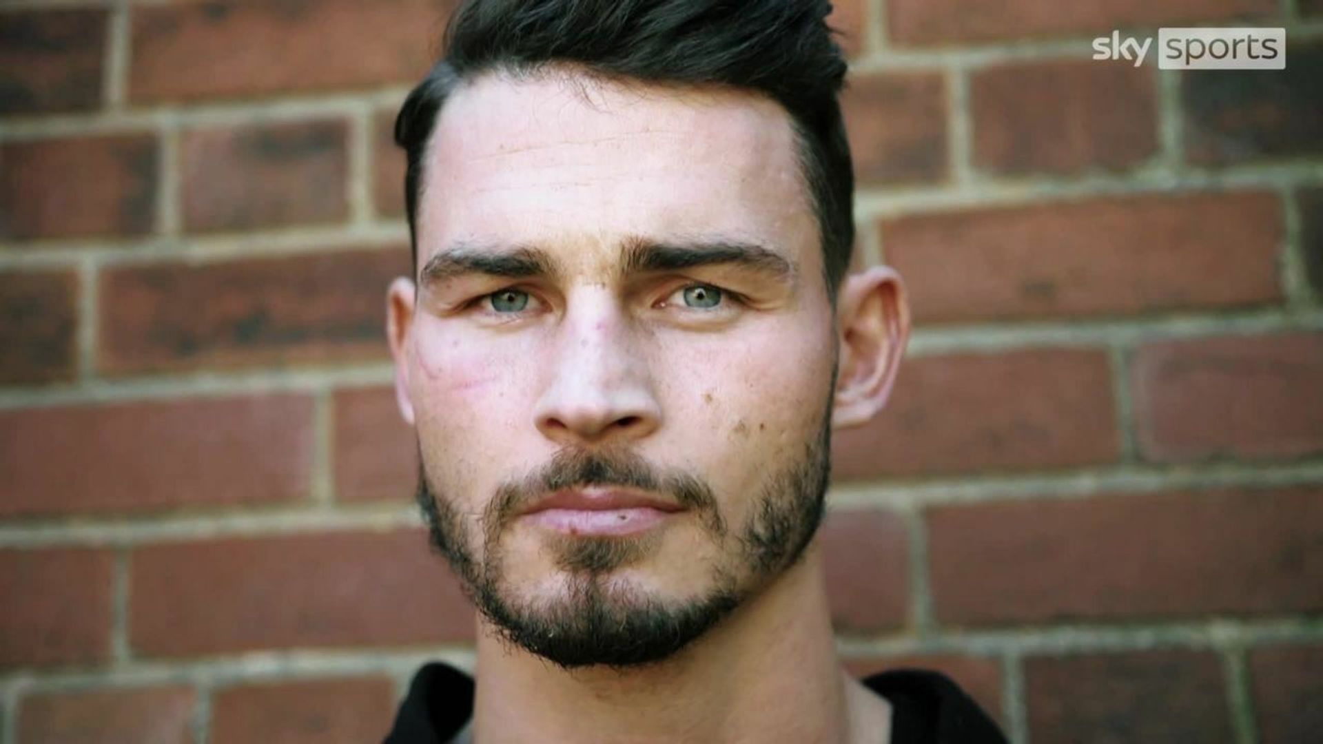 Stevie Ward - Living With Concussion airs Wednesday