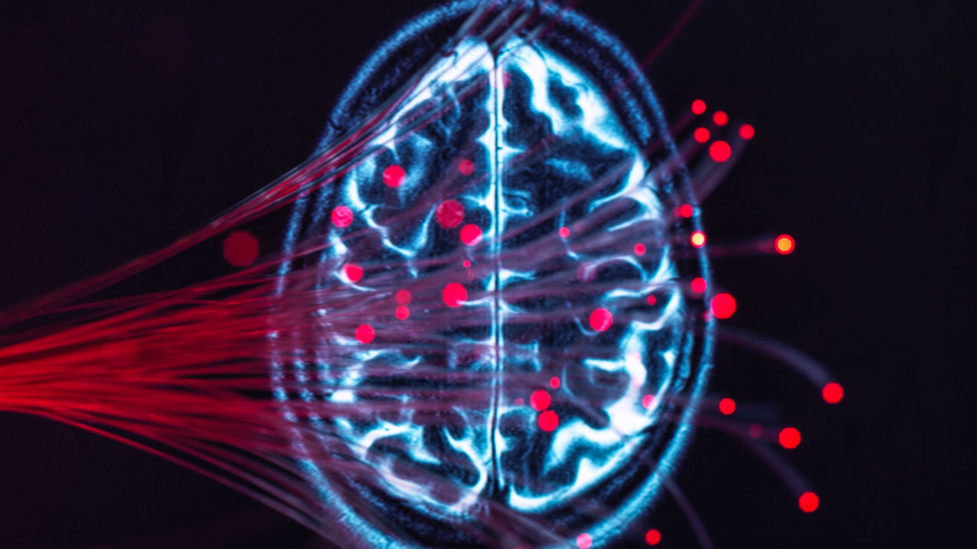 Researchers to review link between sport and dementia