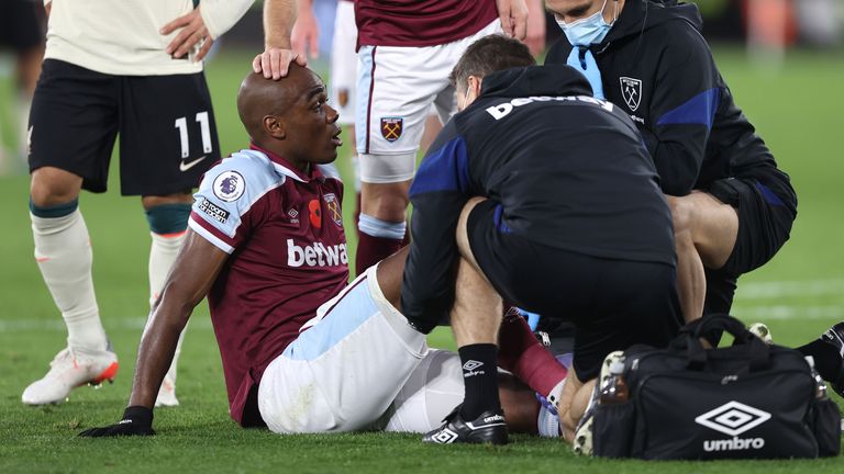 Angelo Ogbonna was injurred during Sunday’s Premier League victory against Liverpool