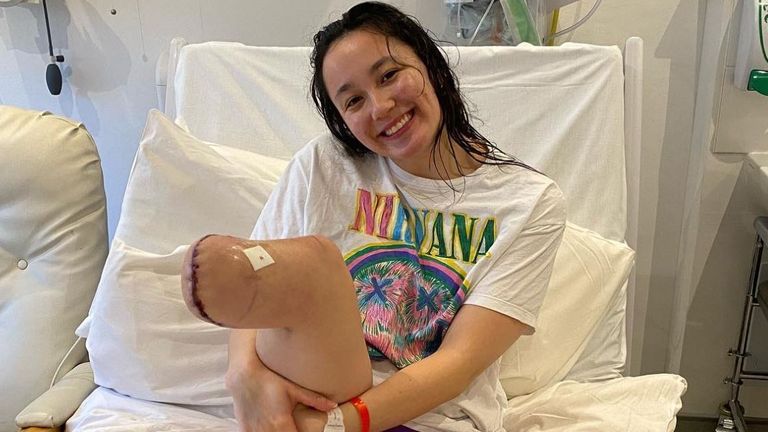 Alice Tai says she is 'happy, healthy and thriving' after her amputation. Pic: Twitter/Alice Tai