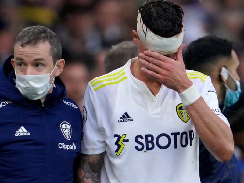 Luke Griggs, the deputy chief executive of the brain injury charity Headway  says further changes are still needed when it comes to dealing with  on-pitch concussion.