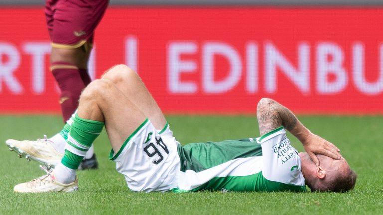 McGeady injured in pre-season friendly