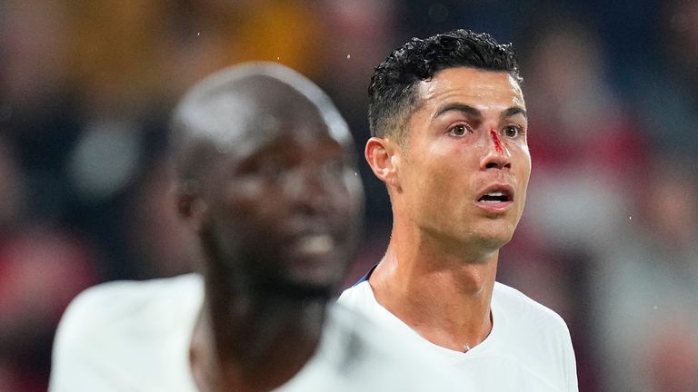 Cristiano Ronaldo de Portugal sufrió una lesión en la nariz durante el partido