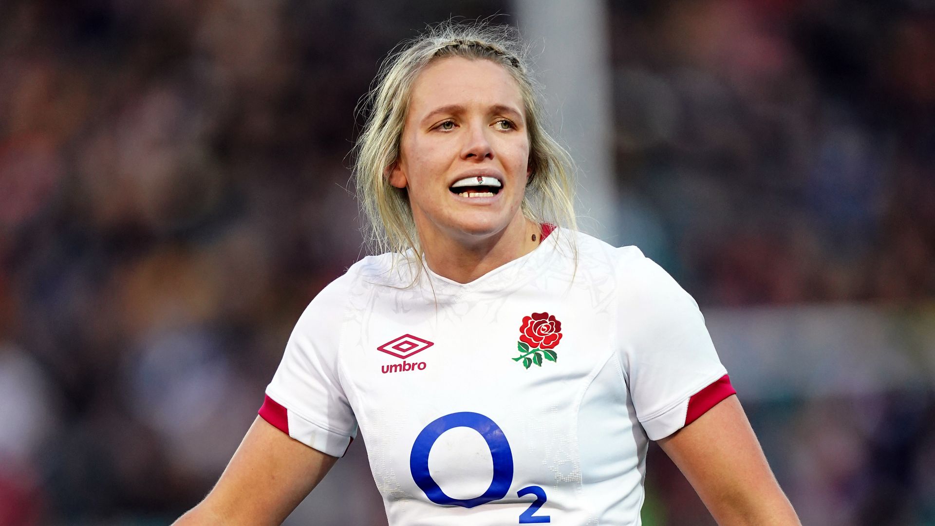 Aldcroft replaces Hunter as Burns makes debut for England against Italy