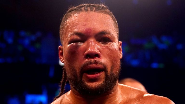 Joe Joyce's eye was damaged in the Zhilei Zhang fight, but not fractured