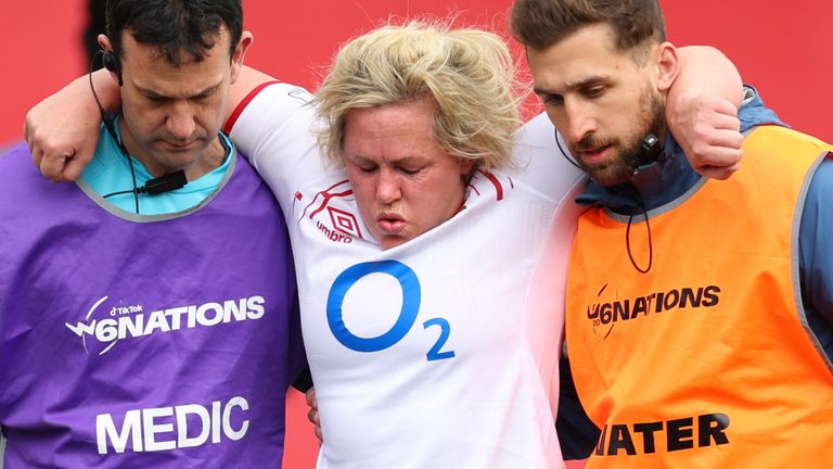 Marlie Packer limps off against Ireland