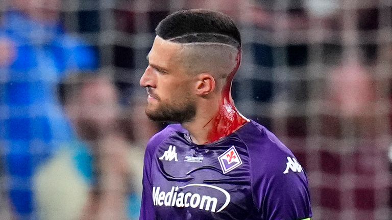 Fiorentina&#39;s Cristiano Biraghi bleeds from his head after being injured by an object thrown from the stands during the Europa Conference League final