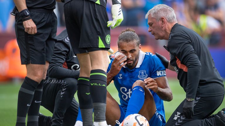 Dominic Calvert-Lewin was forced off by injury before half-time
