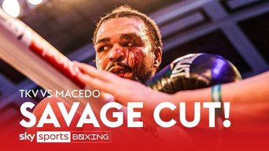 Highlights: TKV suffers shock loss after Macedo opens nasty cut 