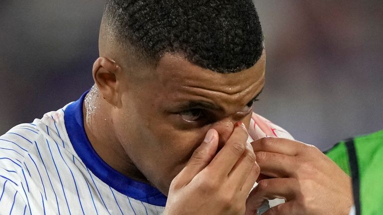 Kylian Mbappe of France holds his nose after suffering an injury during a Group D match between Austria and France at the Euro 2024 soccer tournament in Duesseldorf, Germany, Monday, June 17, 2024. (AP Photo/Martin Meissner)