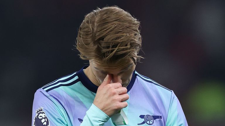 Martin Odegaard menunjukkan kekecewaannya terhadap Man Utd