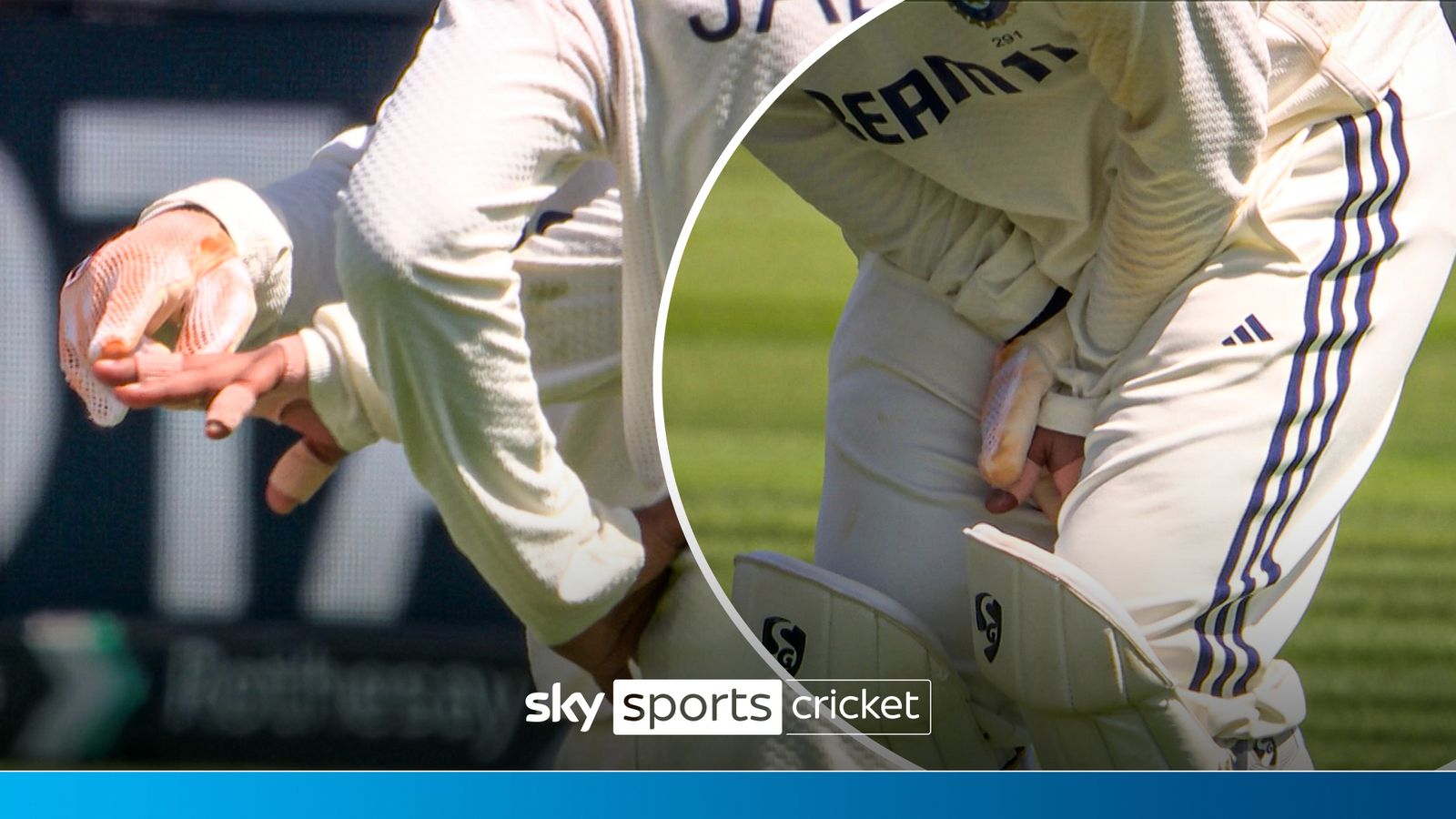 https://e0.365dm.com/25/07/1600x900/skysports-pant-injury-cricket_6961924.jpg?20250710150202