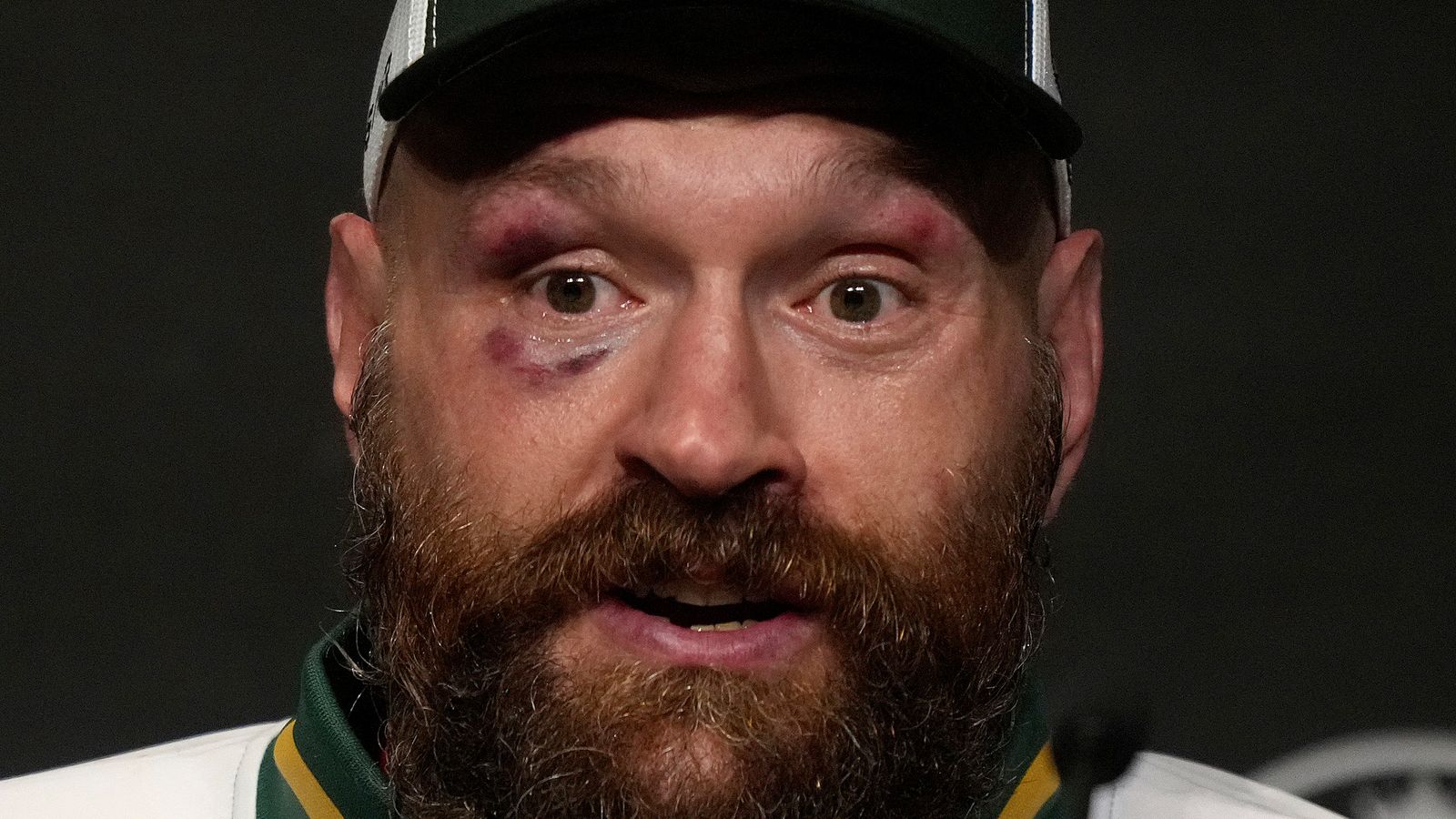 https://e0.365dm.com/25/07/1600x900/skysports-tyson-fury-boxing_6969118.jpg?20250720095103
