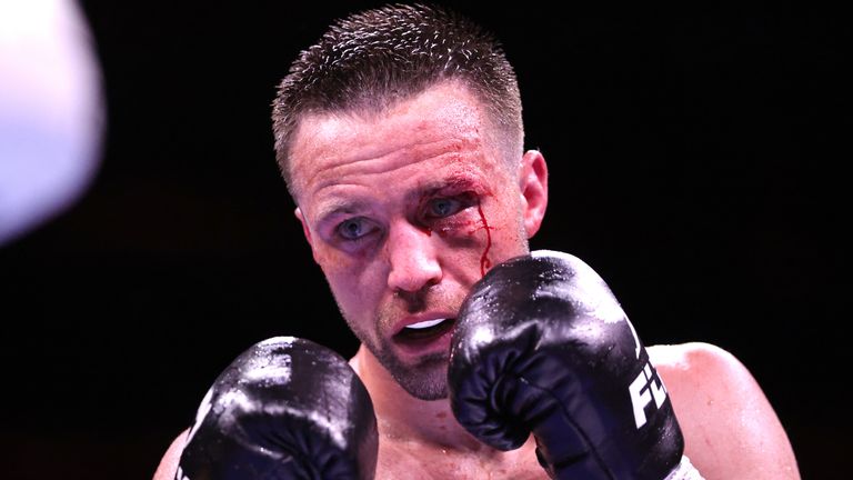 A dangerous eye injury has forced Josh Taylor to retire.