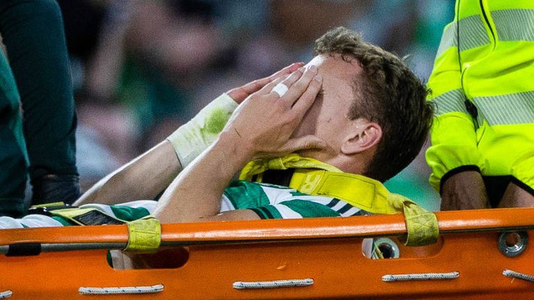 Celtic are waiting to discover how long Alistair Johnston will be out for